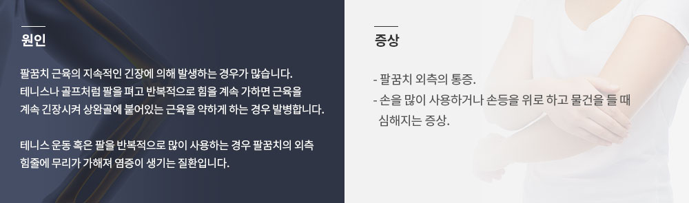 테니스엘보의 원인과 증상